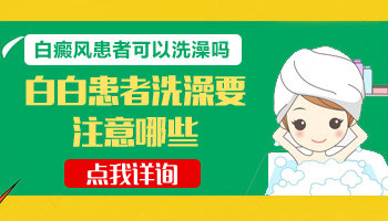 白癜风做完308治疗后发红能洗澡不