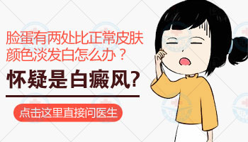 小儿面部白斑怎么回事