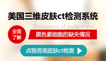 检查白斑是不是白癜风做皮肤cT准吗