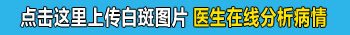 发送白斑图片在线医生为你判断