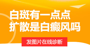 脸颊白斑有点变多了是怎么回事