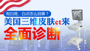 美国三维皮肤ct查白斑会误诊吗