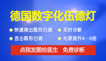 脸上白点是不是白癜风做伍德灯就能查出来吗