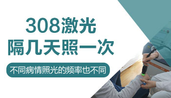 308激光治疗白癜风大概几个疗程有效果