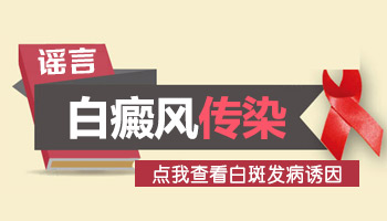 夫妻一方有白癜风另一方会被传染吗