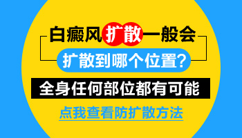 手臂上小白斑不治疗会扩散到其他位置吗