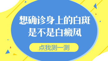 宝宝额头上有块不明显的白斑是不是白癜风