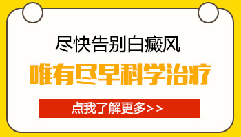 黑色素细胞移植白癜风以后白斑后期会不会复发