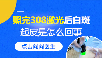 7岁宝宝白癜风照完308后起皮怎么回事